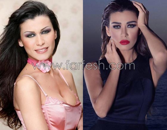 صور فنانات قمن بتكبير الشفاه. بينهن هيفاء واحلام وغادة. الفرق كبير قبل وبعد! صورة رقم 12