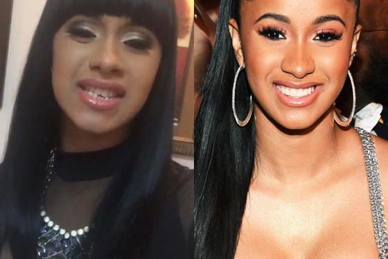 10 نجمات من هوليوود يعترفن بإجراء عمليات التجميل - صور قبل وبعد   صورة رقم 1