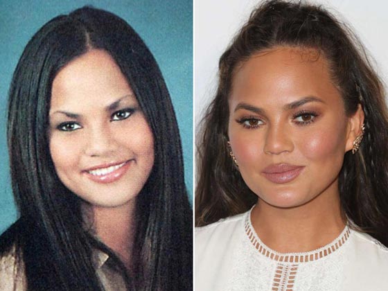 10 نجمات من هوليوود يعترفن بإجراء عمليات التجميل - صور قبل وبعد   صورة رقم 4