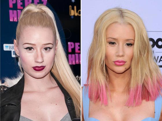 10 نجمات من هوليوود يعترفن بإجراء عمليات التجميل - صور قبل وبعد   صورة رقم 7