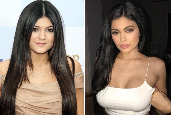 10 نجمات من هوليوود يعترفن بإجراء عمليات التجميل - صور قبل وبعد   صورة رقم 6