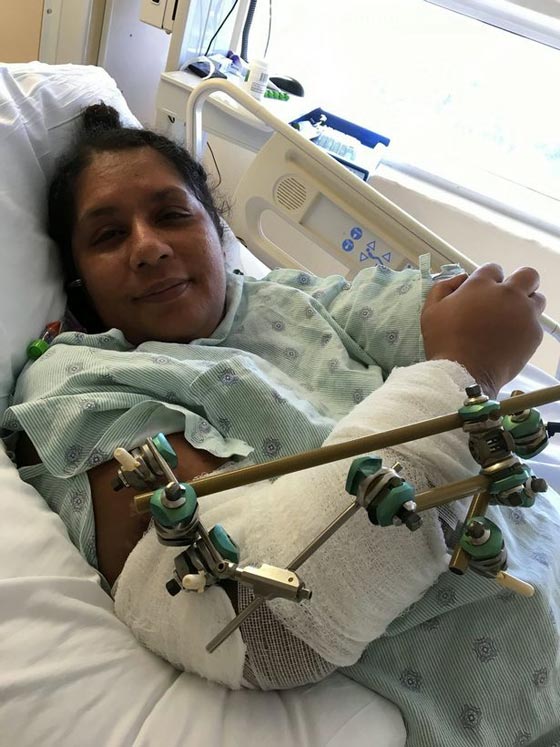 صور مؤلمة: وحشية كلب ربته صاحبته 9 سنوات، فأكل ذراعها في 9 دقائق! صورة رقم 1 صور مؤلمة: وحشية كلب ربته صاحبته 9 سنوات، فأكل ذراعها في 9 دقائق! صورة رقم 1