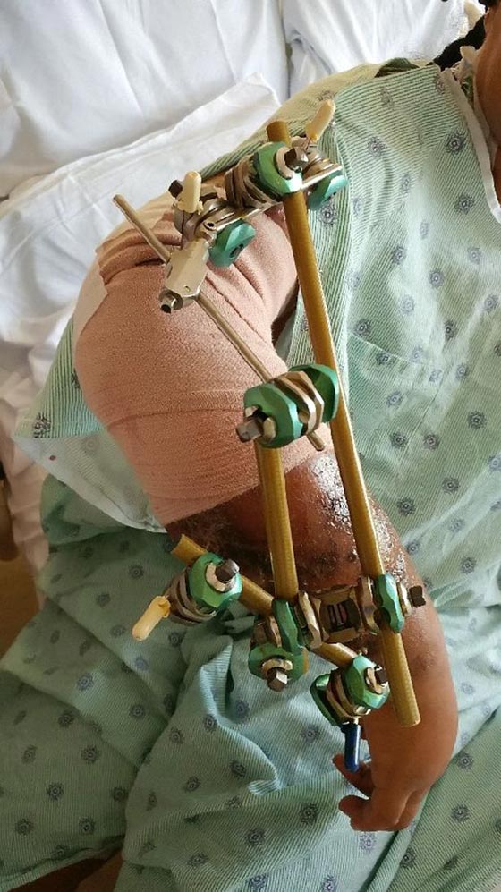 صور مؤلمة: وحشية كلب ربته صاحبته 9 سنوات، فأكل ذراعها في 9 دقائق! صورة رقم 4 صور مؤلمة: وحشية كلب ربته صاحبته 9 سنوات، فأكل ذراعها في 9 دقائق! صورة رقم 4