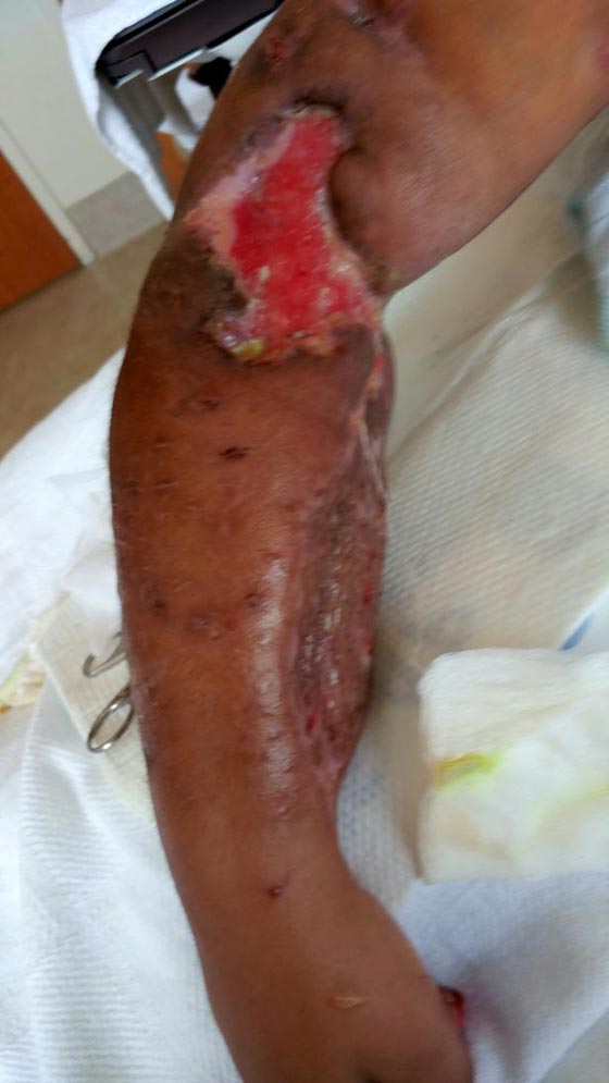 صور مؤلمة: وحشية كلب ربته صاحبته 9 سنوات، فأكل ذراعها في 9 دقائق! صورة رقم 5 صور مؤلمة: وحشية كلب ربته صاحبته 9 سنوات، فأكل ذراعها في 9 دقائق! صورة رقم 5