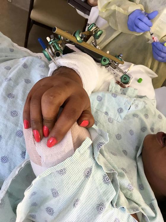 صور مؤلمة: وحشية كلب ربته صاحبته 9 سنوات، فأكل ذراعها في 9 دقائق! صورة رقم 10 صور مؤلمة: وحشية كلب ربته صاحبته 9 سنوات، فأكل ذراعها في 9 دقائق! صورة رقم 10