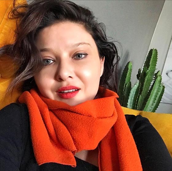 فيديو وصور: نجمة تركية تشوّه وجهها بعمليات التجميل! صورة رقم 1