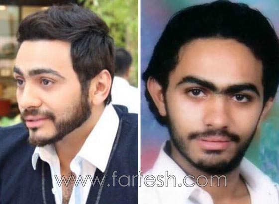 بالصور: تامر حسني متهم بعملية تجميل إضافية بعد الغمازة في الذقن!    صورة رقم 3