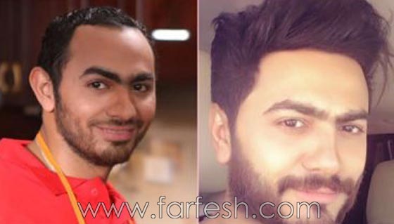 بالصور: تامر حسني متهم بعملية تجميل إضافية بعد الغمازة في الذقن!    صورة رقم 4