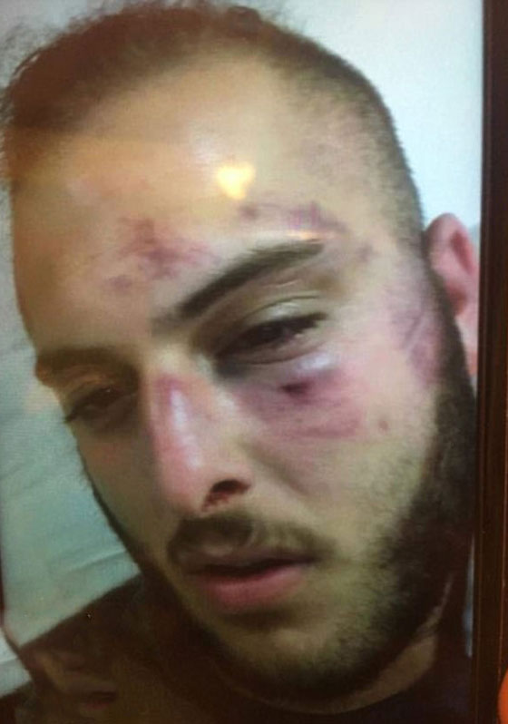 خناقة دموية في استراليا بين 30 رجلًا وامرأة بسبب (شبشب)! صورة رقم 4 خناقة دموية في استراليا بين 30 رجلًا وامرأة بسبب (شبشب)! صورة رقم 4