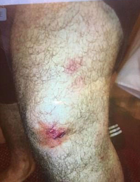 خناقة دموية في استراليا بين 30 رجلًا وامرأة بسبب (شبشب)! صورة رقم 5 خناقة دموية في استراليا بين 30 رجلًا وامرأة بسبب (شبشب)! صورة رقم 5