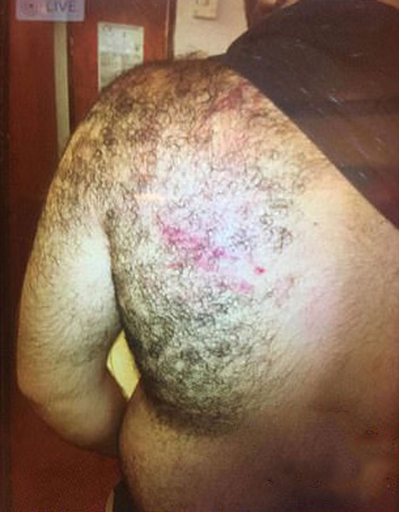 خناقة دموية في استراليا بين 30 رجلًا وامرأة بسبب (شبشب)! صورة رقم 6 خناقة دموية في استراليا بين 30 رجلًا وامرأة بسبب (شبشب)! صورة رقم 6