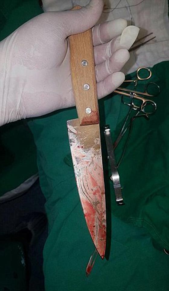 بالفيديو.. مشهد صادم لشاب مطعون بسكين ينتظر الإسعاف! صورة رقم 6 بالفيديو.. مشهد صادم لشاب مطعون بسكين ينتظر الإسعاف! صورة رقم 6