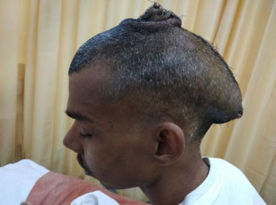 رأسان بواحد.. صور شاب هندي بورم قياسي صورة رقم 4 رأسان بواحد.. صور شاب هندي بورم قياسي صورة رقم 4