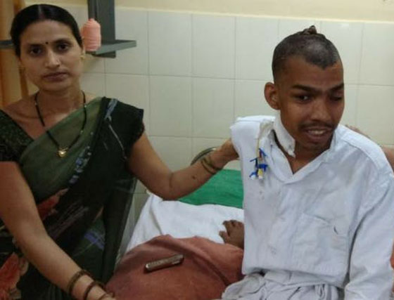 رأسان بواحد.. صور شاب هندي بورم قياسي صورة رقم 3 رأسان بواحد.. صور شاب هندي بورم قياسي صورة رقم 3