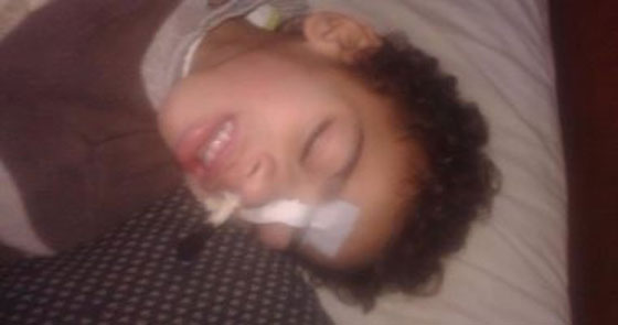 صور طفل مصري يكاد يموت! تحوّل لهيكل عظمي وينتظر رد وزارة الصحةّ! صورة رقم 4