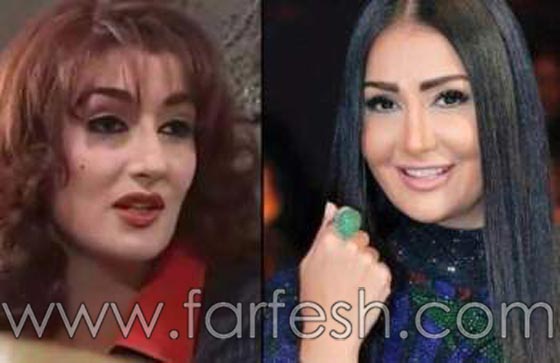 بالصور: لن تصدقوا كيف كان شكل غادة عبد الرازق قبل عمليات التجميل  صورة رقم 2