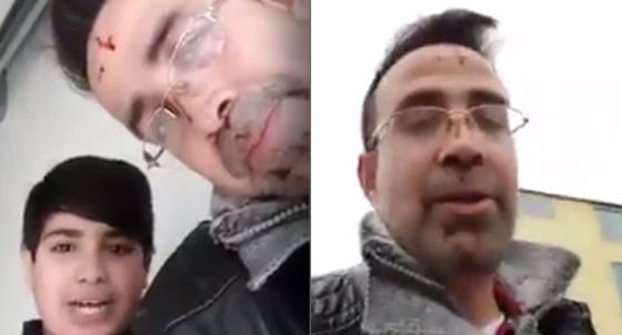 بالفيديو: سوري قتل زوجته وروى جريمته المفزعة في بث مباشر والدماء تسيل منه صورة رقم 1