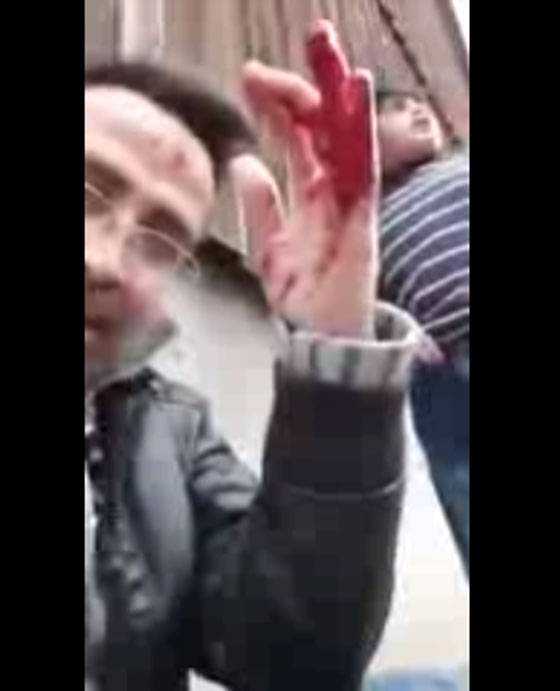 بالفيديو: سوري قتل زوجته وروى جريمته المفزعة في بث مباشر والدماء تسيل منه صورة رقم 2