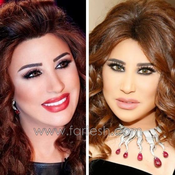 بالفيديو نجوى كرم تعترف بكل جرأة: لهذا السبب تورّم وجهي!   صورة رقم 1