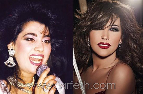 صور نجوم العرب قبل الشهرة.. حسب رأيكم هل غير المال مظهرهم؟ صورة رقم 4