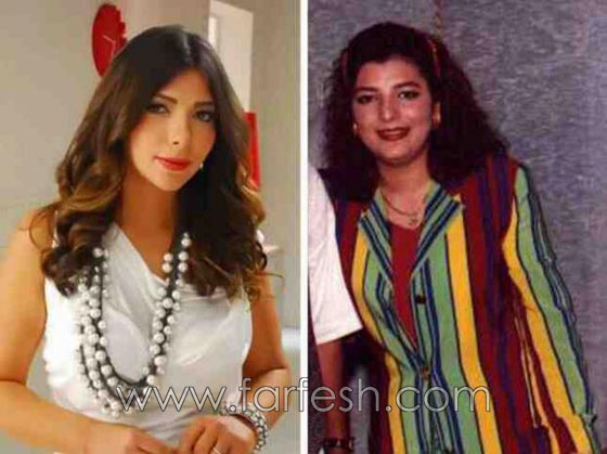 صور نجوم العرب قبل الشهرة.. حسب رأيكم هل غير المال مظهرهم؟ صورة رقم 5