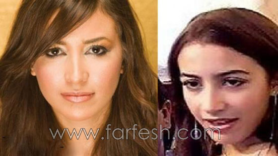 صور نجوم العرب قبل الشهرة.. حسب رأيكم هل غير المال مظهرهم؟ صورة رقم 7