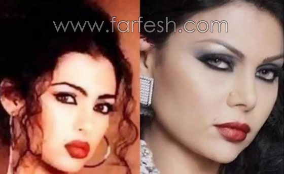 صور نجوم العرب قبل الشهرة والثراء.. هل غيّر المال مظهرهم؟ صورة رقم 2