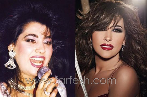 صور نجوم العرب قبل الشهرة والثراء.. هل غيّر المال مظهرهم؟ صورة رقم 4
