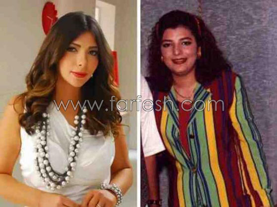 صور نجوم العرب قبل الشهرة والثراء.. هل غيّر المال مظهرهم؟ صورة رقم 5