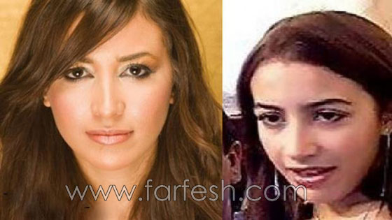 صور نجوم العرب قبل الشهرة والثراء.. هل غيّر المال مظهرهم؟ صورة رقم 7