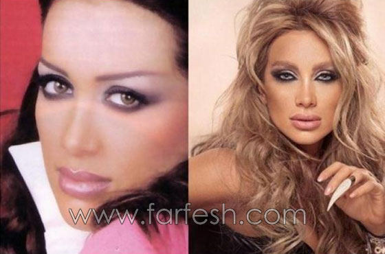 صور نجوم العرب قبل الشهرة والثراء.. هل غيّر المال مظهرهم؟ صورة رقم 9
