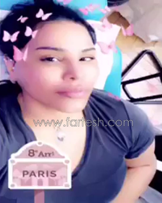 فيديو احلام بدون مكياج تكشف عن خضوعها لعملية تجميل وحقن الشفاه! صورة رقم 1