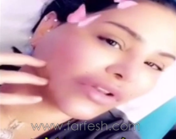 فيديو احلام بدون مكياج تكشف عن خضوعها لعملية تجميل وحقن الشفاه! صورة رقم 2