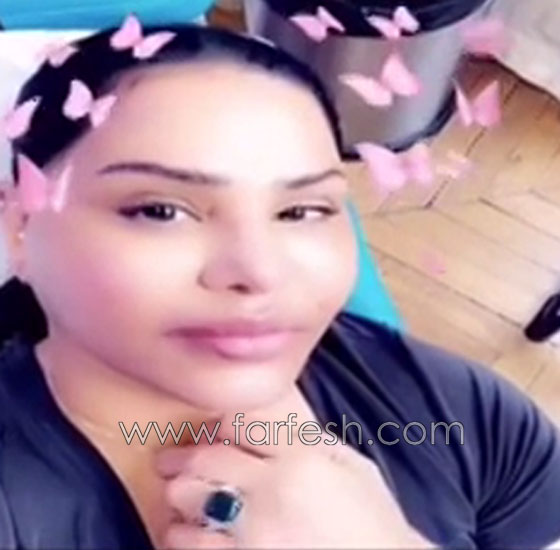 فيديو احلام بدون مكياج تكشف عن خضوعها لعملية تجميل وحقن الشفاه! صورة رقم 3