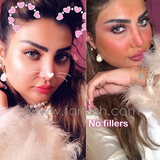  فنانة كويتية تبالغ بعمليات التجميل والجمهور: سينفجر وجهك من كثرة النفخ! صورة رقم 1