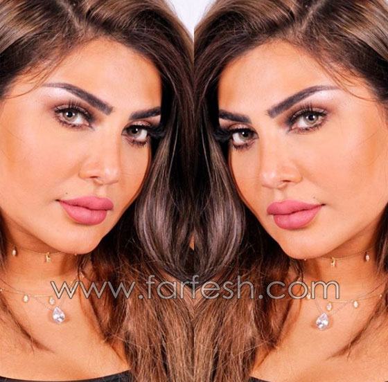  فنانة كويتية تبالغ بعمليات التجميل والجمهور: سينفجر وجهك من كثرة النفخ! صورة رقم 9