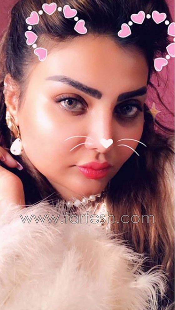  فنانة كويتية تبالغ بعمليات التجميل والجمهور: سينفجر وجهك من كثرة النفخ! صورة رقم 2