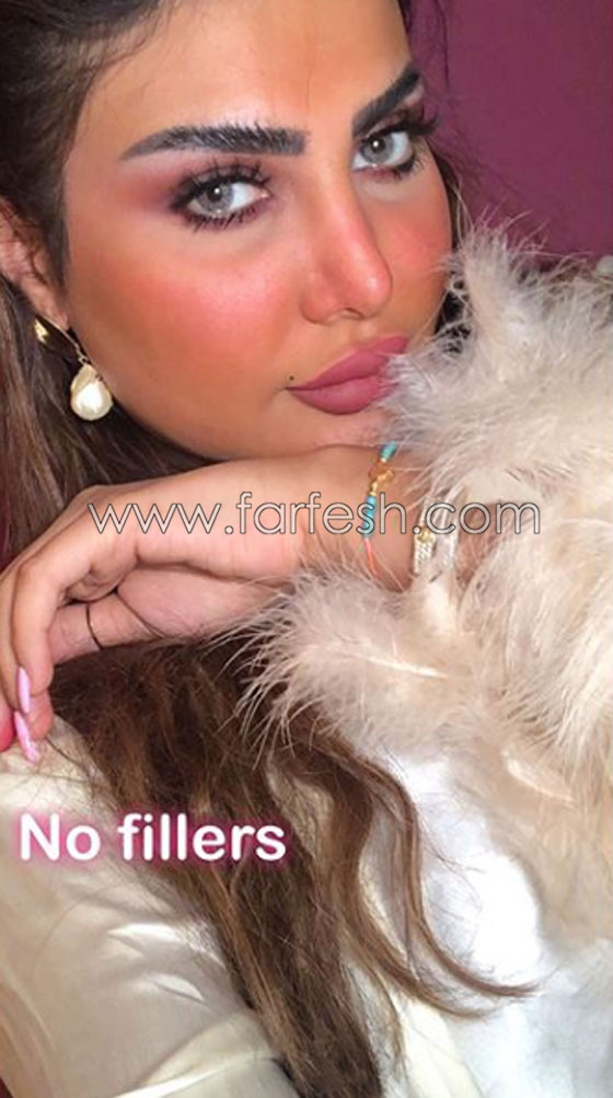  فنانة كويتية تبالغ بعمليات التجميل والجمهور: سينفجر وجهك من كثرة النفخ! صورة رقم 3