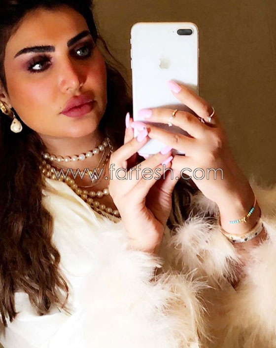  فنانة كويتية تبالغ بعمليات التجميل والجمهور: سينفجر وجهك من كثرة النفخ! صورة رقم 10