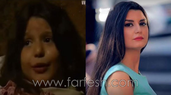 بالصور: هكذا أصبح أطفال المسلسلات السورية بعد سنوات طويلة صورة رقم 9