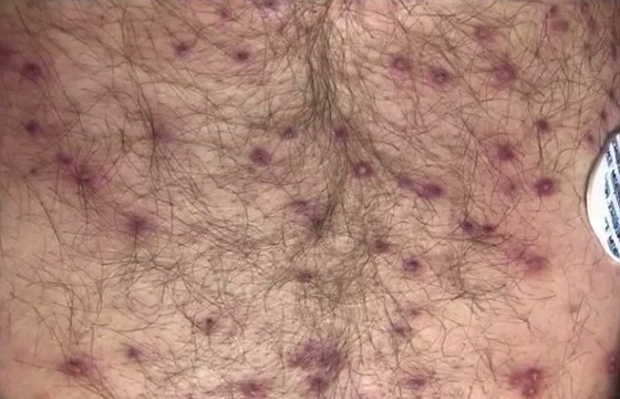 رجل أمريكي ينجو من الموت بأعجوبة بعد تعرضه لأكثر من 600 لدغة من النحل القاتل صورة رقم 2