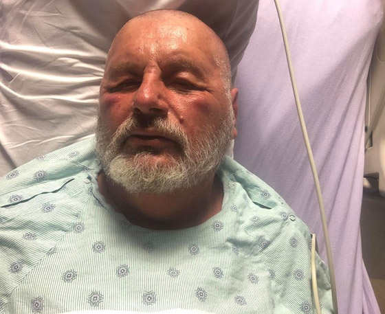 رجل أمريكي ينجو من الموت بأعجوبة بعد تعرضه لأكثر من 600 لدغة من النحل القاتل صورة رقم 6