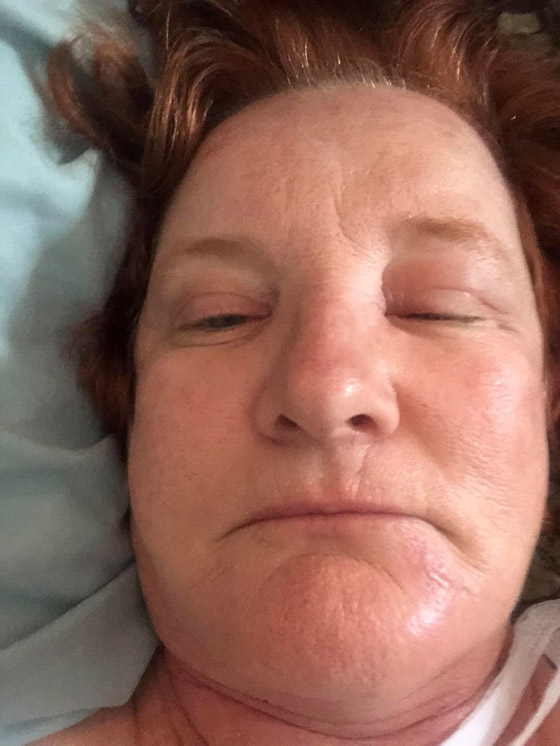 رجل أمريكي ينجو من الموت بأعجوبة بعد تعرضه لأكثر من 600 لدغة من النحل القاتل صورة رقم 7