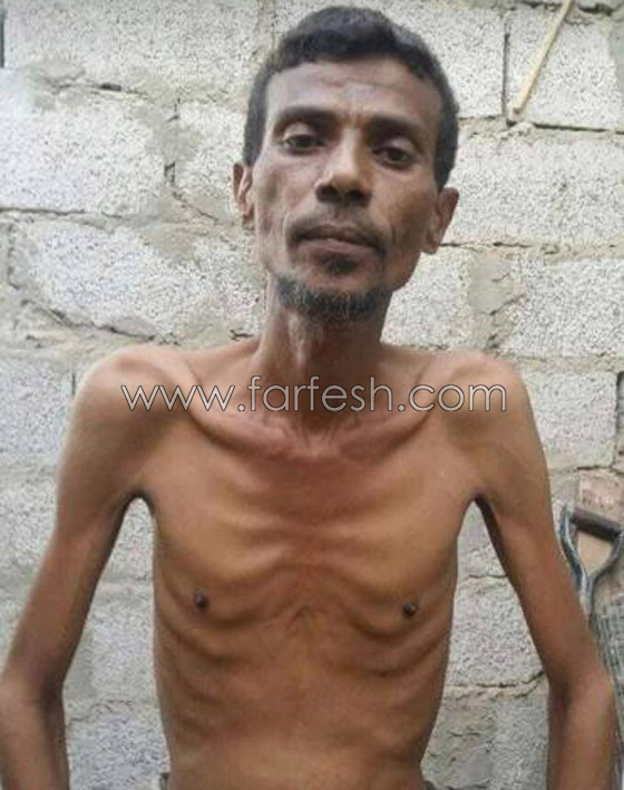 وفاة الفنان اليمني الشهير سالم بحر بسبب الجوع! صورته الاخيرة مؤلمة صورة رقم 1