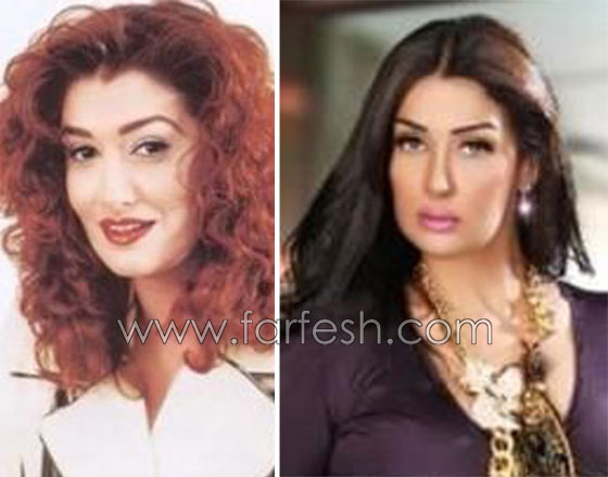 صور 14 فنانة مصرية قبل وبعد عمليات التجميل.. الفرق هائل! صورة رقم 1