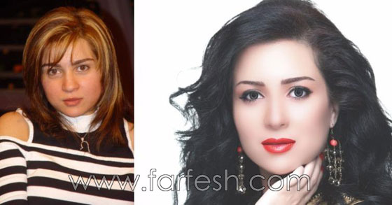 صور 14 فنانة مصرية قبل وبعد عمليات التجميل.. الفرق هائل! صورة رقم 5