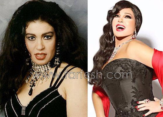 صور 14 فنانة مصرية قبل وبعد عمليات التجميل.. الفرق هائل! صورة رقم 6