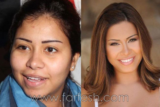 صور 14 فنانة مصرية قبل وبعد عمليات التجميل.. الفرق هائل! صورة رقم 8