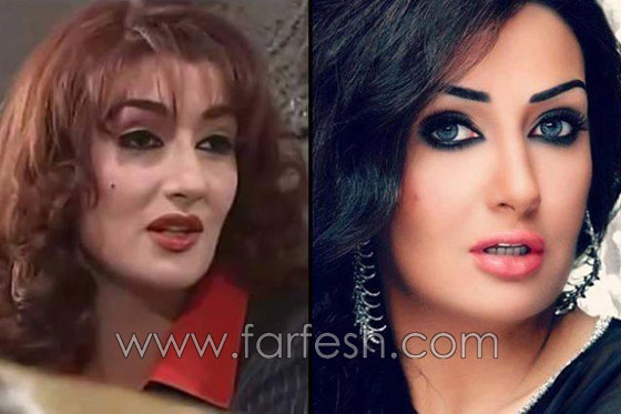 صور 14 فنانة مصرية قبل وبعد عمليات التجميل.. الفرق هائل! صورة رقم 9