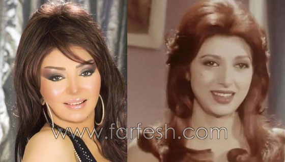 صور 14 فنانة مصرية قبل وبعد عمليات التجميل.. الفرق هائل! صورة رقم 10